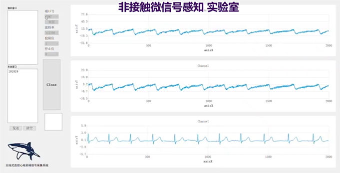 多生命體征檢測(cè)